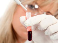 Анализ крови на раковые клетки