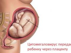 цмв при беременности