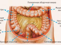 дискинезия толстого кишечника