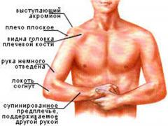 вывих плечевого сустава симптомы