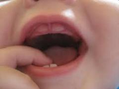 как облегчить прорезывание зубов у ребенка