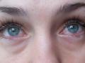 травма роговицы глаза лечение