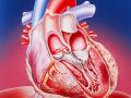 абдоминальная форма инфаркта миокарда