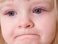 противовирусные глазные капли для детей