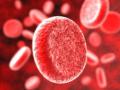 Серповидноклеточная анемия является наследственным заболеванием