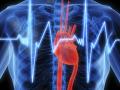 Тромбоэмболия легочной артерии является тяжелой сердечно-сосудистой патологией