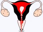 менструация