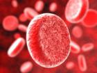 Серповидноклеточная анемия является наследственным заболеванием