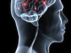 При синдроме Арнольда-Киари нарушена структура головного мозга