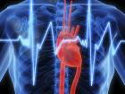 Тромбоэмболия легочной артерии является тяжелой сердечно-сосудистой патологией