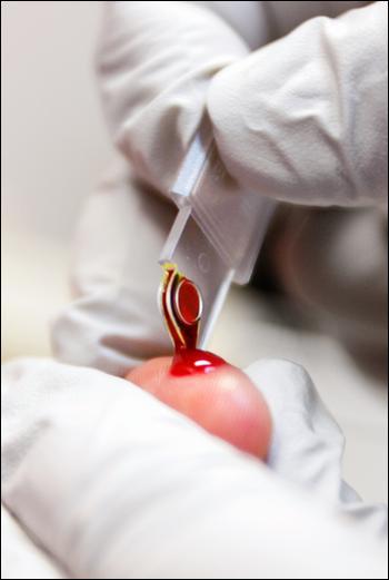 анализ крови натощак