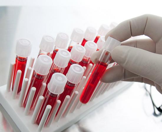 При расшифровке анализа крови определяется уровень лейкоцитов