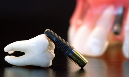 Перед зубным протезированием нужно пройти полное обследование