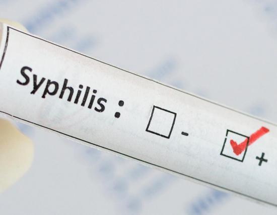 Симптомы сифилиса проявляются спустя время